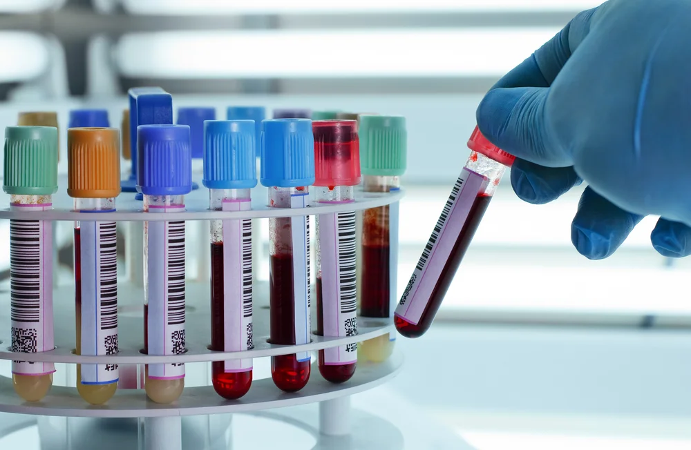 Laboratory Analysis