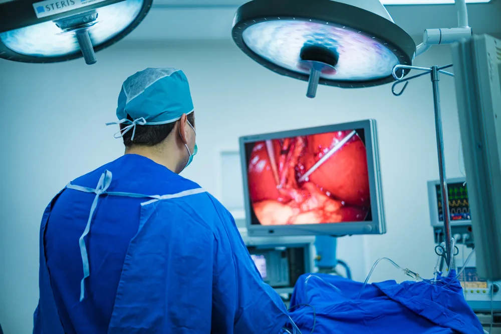 Laparoscopic Surgery